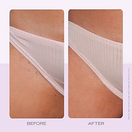 Ingrown Hair Pads - Batık tüyler için biyolojik olarak bozunabilen diskler x60